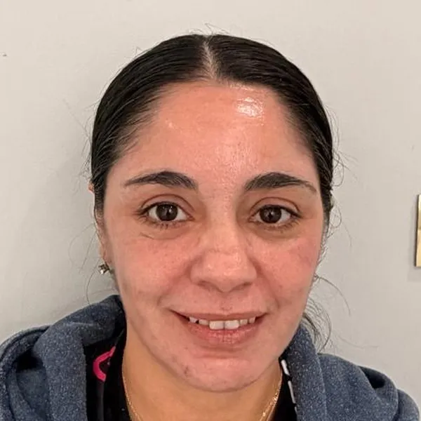 Before and after at LP Beauty & Wellness Spa