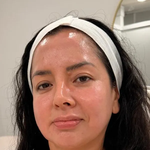 Before and after at LP Beauty & Wellness Spa
